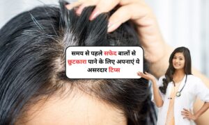 White Hair Problem: समय से पहले सफेद बालों से छुटकारा पाने के लिए अपनाएं ये असरदार टिप्स